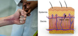 Scar Treatments that Work