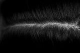 Dry Scalp VS Dandruff: Do You Know the Difference?