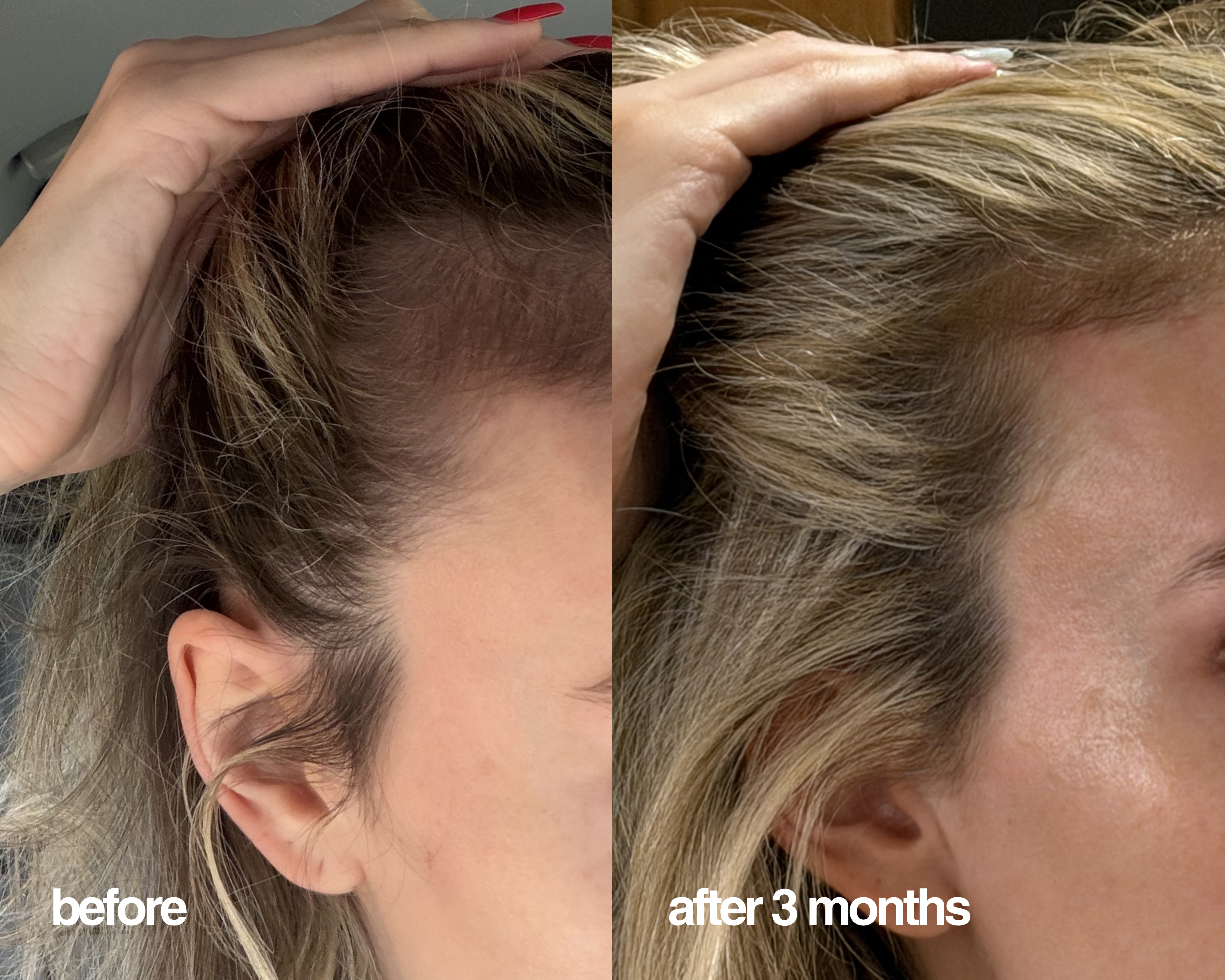 Feel Confident® Hair System