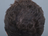Before Feel Confident clinical haircare results for men