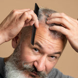 Man experiencing hair thinning exploring Feel Confident doctor-guided hair loss treatment options
