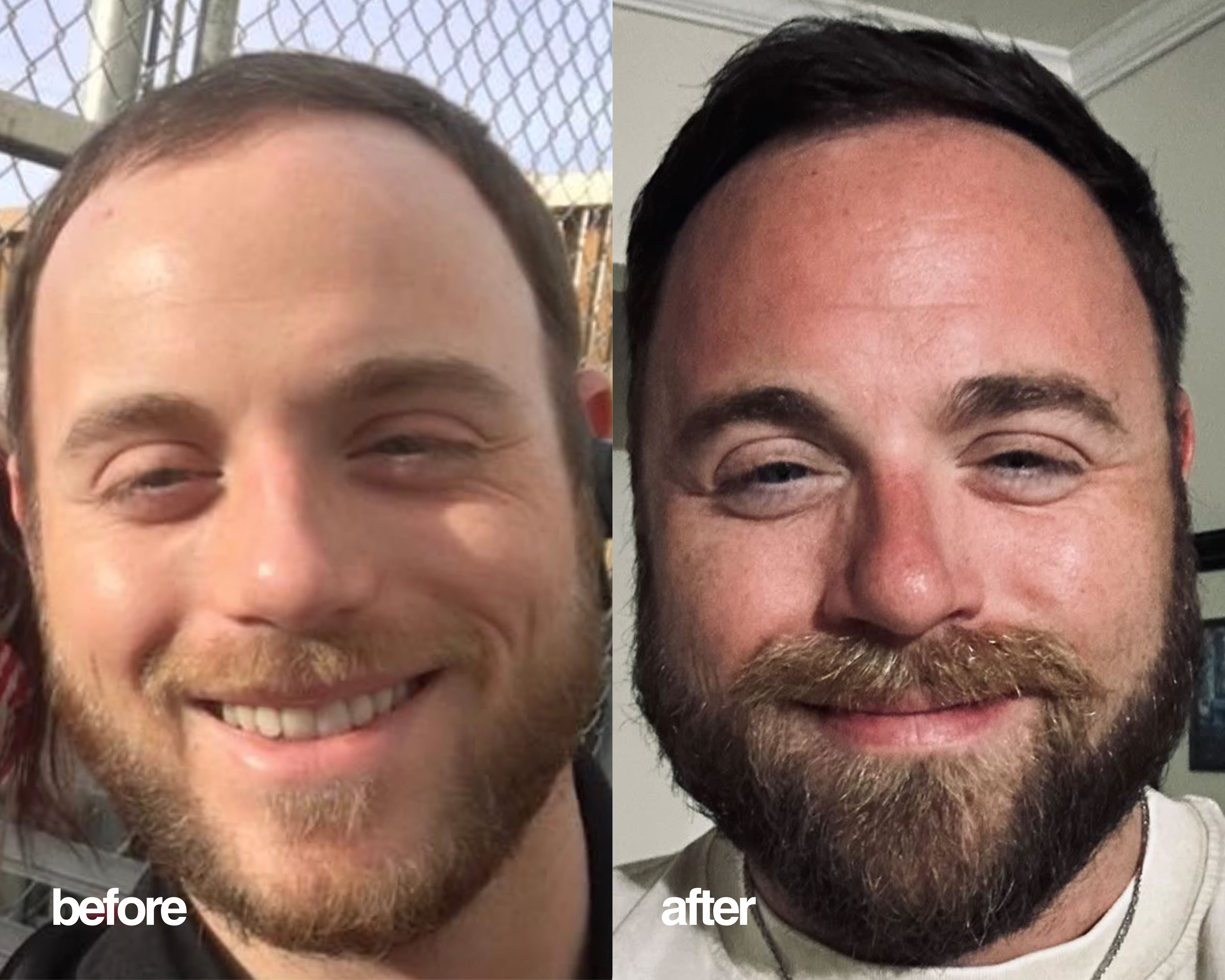 Feel Confident® Hair System